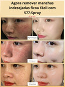 Skin Expert Spray 577 — rotina diária para manchas ✨ 50% de DESCONTO + FRETE GRÁTIS!
