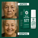 Skin Expert Spray 577 — rotina diária para manchas ✨ 50% de DESCONTO + FRETE GRÁTIS!