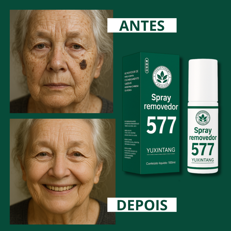 Spray- 577 Remove manchas de SOL, IDADE E MELASMA! 50% DE DESCONTO + FRETE GRÁTIS!