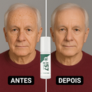 Skin Expert Spray 577 — rotina diária para manchas ✨ 50% de DESCONTO + FRETE GRÁTIS!