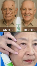 Skin Expert Spray 577 — rotina diária para manchas ✨ 50% de DESCONTO + FRETE GRÁTIS!