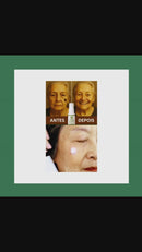 Skin Expert Spray 577 — rotina diária para manchas ✨ 50% de DESCONTO + FRETE GRÁTIS!