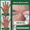 Skin Expert Spray 577 — rotina diária para manchas ✨ 50% de DESCONTO + FRETE GRÁTIS!