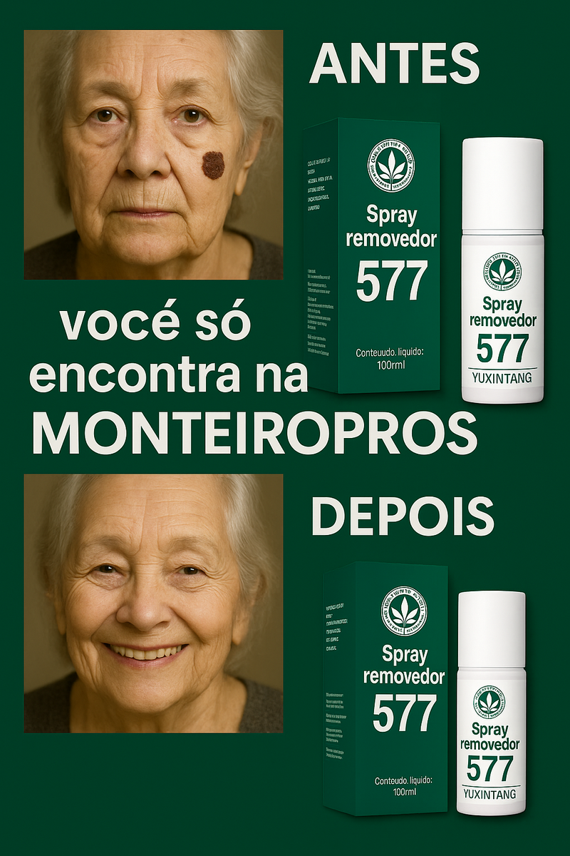 Spray- 577 Remove manchas de SOL, IDADE E MELASMA! 50% DE DESCONTO + FRETE GRÁTIS!